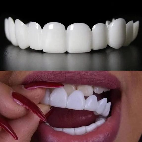 Perfect Smile Pro™ SnapOn Smile Veneers - 50% OFF - TrenLit