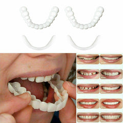 Perfect Smile Pro™ SnapOn Smile Veneers - 50% OFF - TrenLit