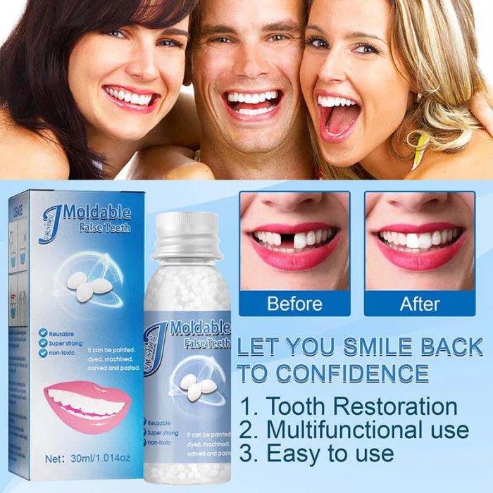 SmileCraft™ Instant Tooth Repair Kit | 1+1 FREE - TrenLit