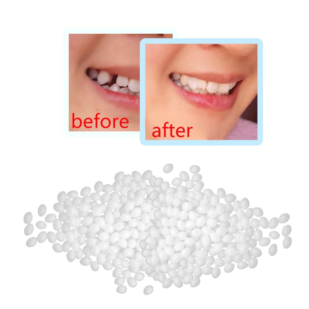 SmileCraft™ Instant Tooth Repair Kit | 1+1 FREE - TrenLit