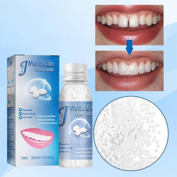 SmileCraft™ Instant Tooth Repair Kit | 1+1 FREE - TrenLit