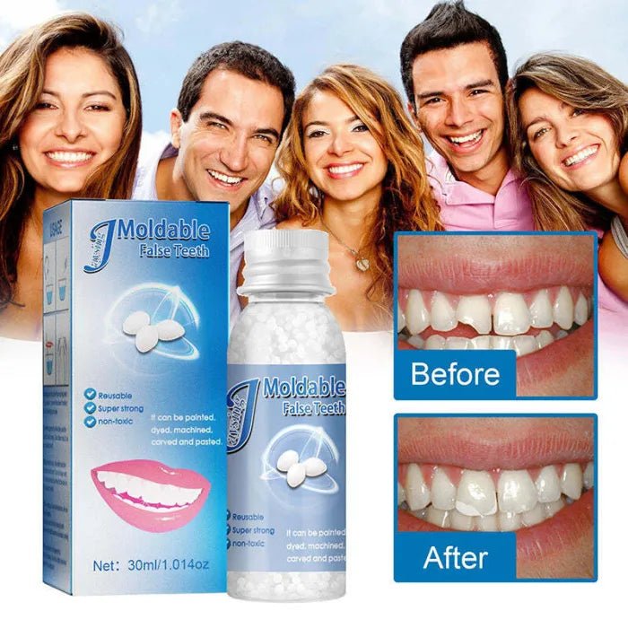 SmileCraft™ Instant Tooth Repair Kit | 1+1 FREE - TrenLit